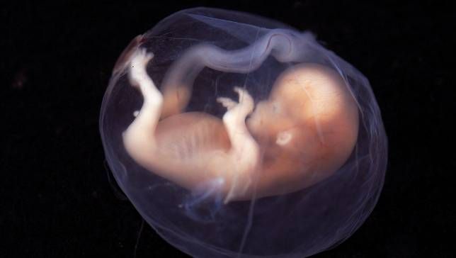 fetus-jpg-653x0_q80_crop-smart